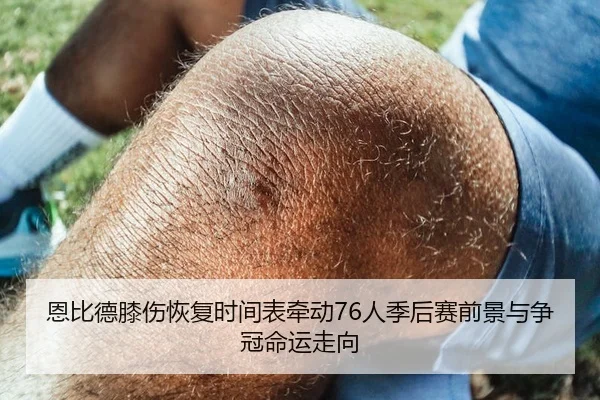 恩比德膝伤恢复时间表牵动76人季后赛前景与争冠命运走向（leyu）
